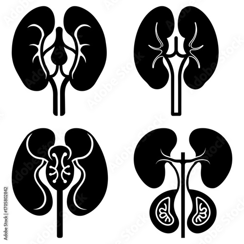 Four kidney illustrations showcasing anatomical variations in black and white medical diagram style
