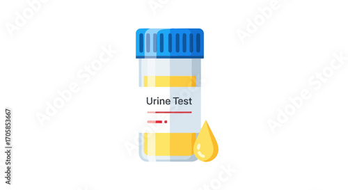 A medical urine test specimen container with a blue screw cap and a yellow liquid sample.