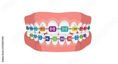 Cartoon human jaw with pink gums and white teeth wearing colorful metal braces.
