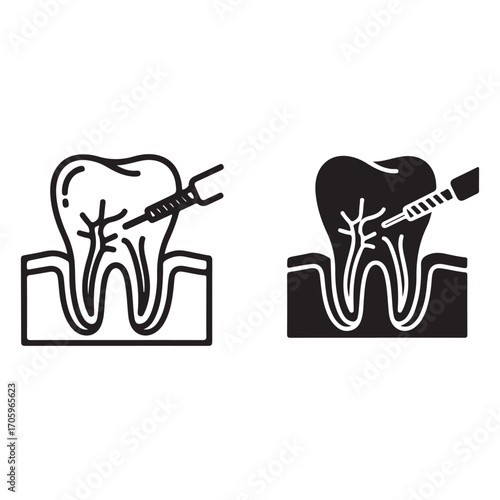 Dental illustration of a root canal procedure in two styles