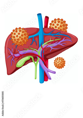Hepatitis b liver infection virus.ai