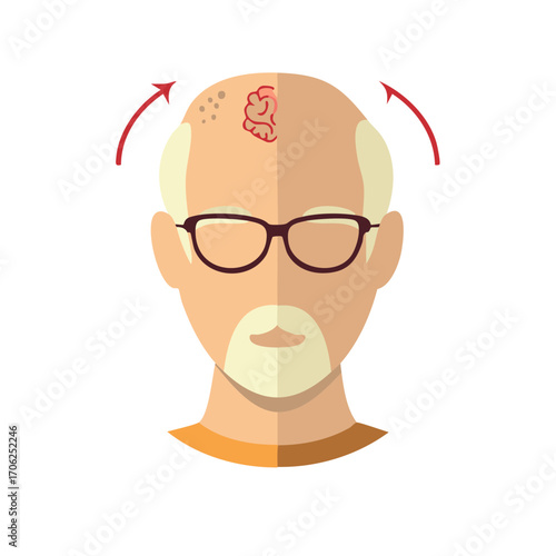 Vector illustration of an older man with a skin condition on his bald head showing a rash and hair loss