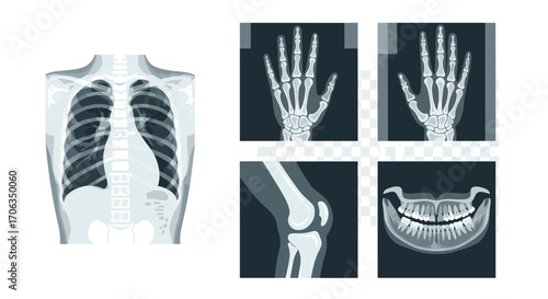 Detailed medical scans showcase human anatomy including chest hand knee and jawbone for diagnostic and educational purposes, Generative AI.