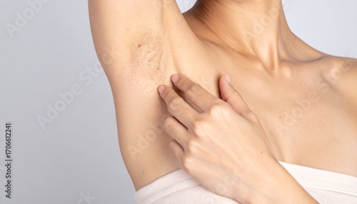 A woman concerned about her armpit, showing dark, bumpy skin and ingrown hairs as a result of shaving or hair removal