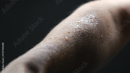 Sweat on a person's skin.
A wet hand due to excessive sweating on a hot day.
Excessive sweating in a person.
Beads of sweat or water on a person's bare skin.