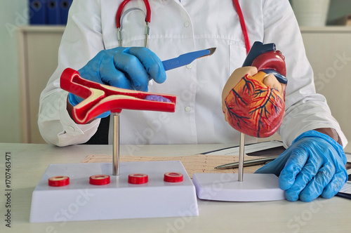 Cardiologist surgeon demonstrates models heart and blood vessel anatomy and scalpel. Heart surgery stenting coronary artery bypass graft