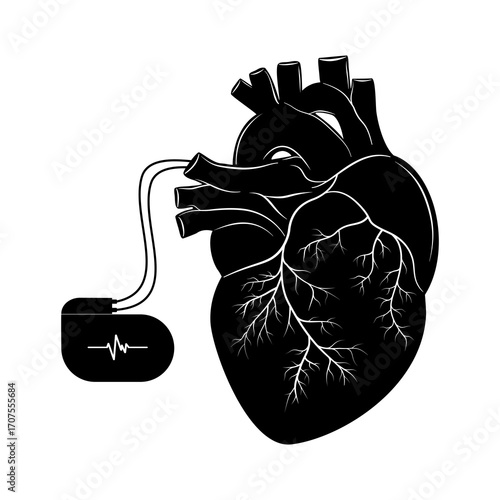 Pacemaker icon, Artificial cardiac pacemaker and heart icon. Flat vector illustration isolated on white background.