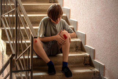 Child injured his knee when he fell on steps. Knee wound on the steps. Blood, scratched skin. Boy holding his injured knee. Unhappy child boy injured leg pain. Man worried about leg injury in rung