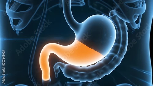 Digestive System Anatomy with Intestinal Inflammation, Acid Reflux, and Gastric Health Issues