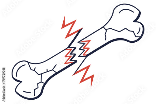 Broken Bone Illustration with Red Lightning Bolt.
