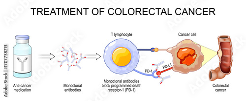 Treatment of cancer. Anti-cancer medication and Monoclonal antibodies