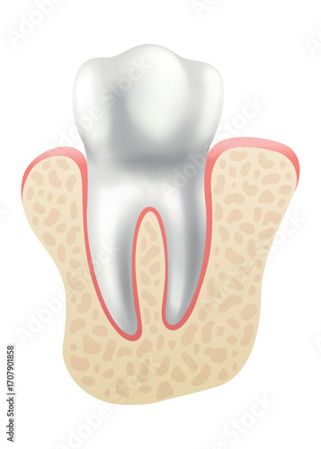 Dental implant. Medical educative infographic poster. Teeth implant, realistic vector design of dentistry. Healthcare, dentist and orthodontist treatment