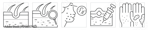 Dermatology icons set. Vector editable stroke.
