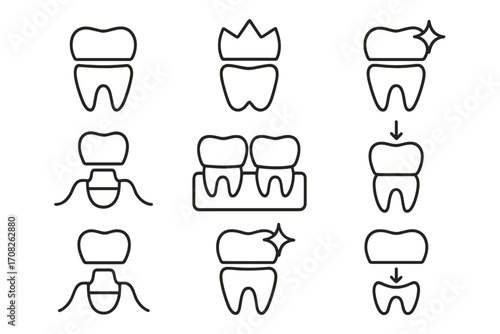 Dental crown, bridge and implant line icons. Tooth restoration pictogram collection. Dentistry, stomatology outline vector signs for web design, clinic, infographics, apps.