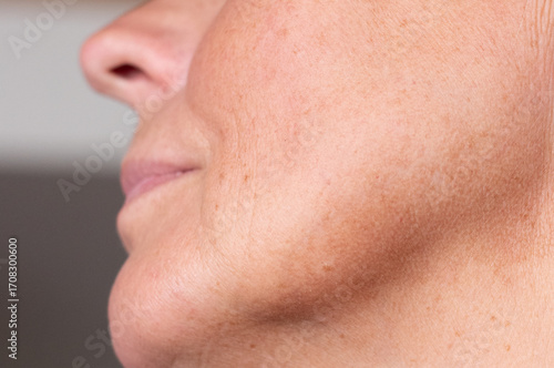 Detailed macro of middle-aged woman’s cheek and jaw showing pigmentation spots, skin texture, and early signs of aging. Ideal for skincare, dermatology, cosmetic and educational use.