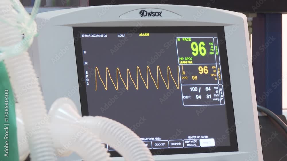 A Close up Shot Of A Modern Medical Patient Monitor Displaying Vital a-close-up-shot-of-a-modern-medical-patient-monitor-displaying-vital