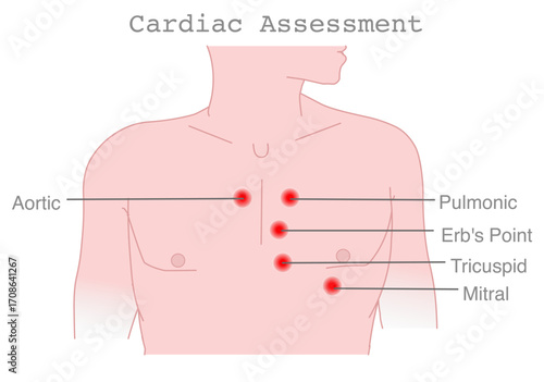 Cardiac assessment points. Areas for auscultation of heart valves. Aortic, pulmonary,  Erb's point, tricuspid.. Vector illustration