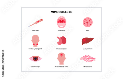 Mononucleosis symptoms poster