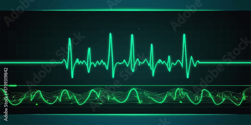 Green EKG line graphs on a medical monitor illustrating the pulse and heartbeat wave