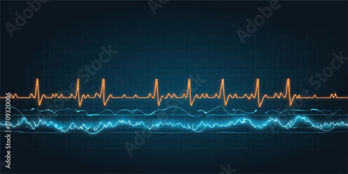 Green electrocardiogram pulse line on a hospital monitor showing a healthy heartbeat