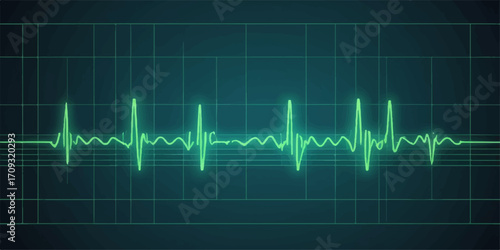 Medical illustration of a heartbeat pulse on an EKG monitor screen showing a life-saving cardiogram graph
