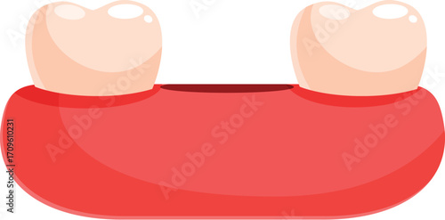 Cartoon illustration of two teeth attached to red gums showing diastema dental problem