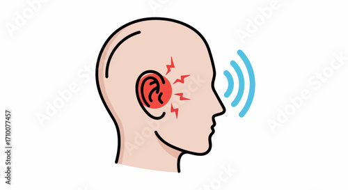 Depiction of tinnitus with ringing sound effect graphic on human head. Tinnitus discomfort visualized with red ear and headache, indicating potential hearing problem.