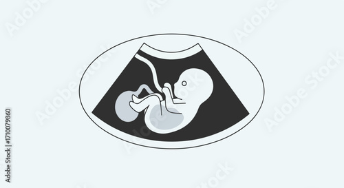 Pregnancy ultrasound depicts fetus in mother's womb. Pregnancy ultrasound images show developing baby, embryonic development, amniotic sac and other gestation features.