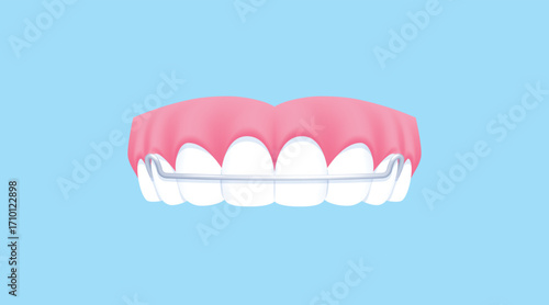 Upper teeth (Hawley retainer) illustration vector design. Dental care concept.