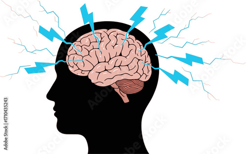 vector of human head silhouette with brain, lightning bolts for anxiety