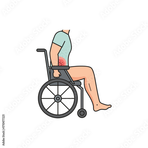 bedsore patient sits in wheelchair showing pressure ulcer skin damage for skin graft surgery purposes