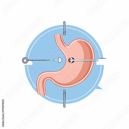 Illustration of Stomach Endoscopy Medical Procedure, Healthcare Diagnostic