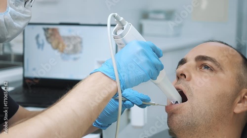 A dentist scans a male patient's jaw with a modern dental scanner. Modern dental clinic. New technologies in dental prosthetics.