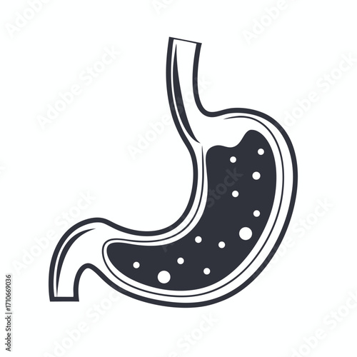 Detailed stomach illustration showing vessel structure in black against white backdrop