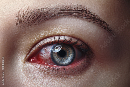 Close-up macro of a gray eye with burst red blood vessels due to insomnia, infection, contact lenses, or allergies. Concept photo for Halloween, horror, and an ophthalmology clinic