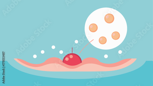 Exosome Delivery A graphic showing exosomes small circular vesicles being introduced to the skins surface after microneedling emphasizing their role in skin healing.