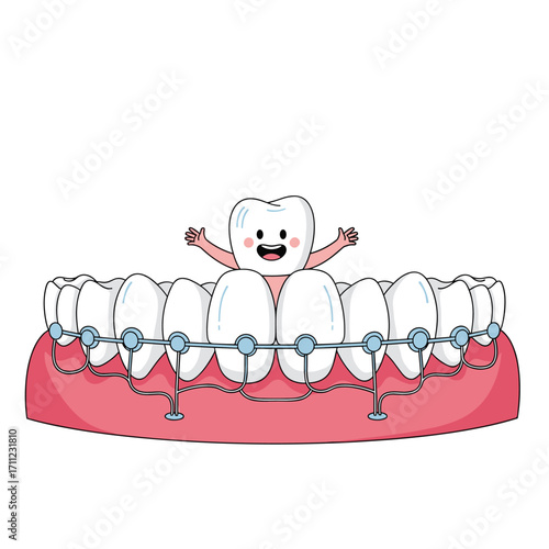 Friendly cartoon tooth smiling happily above a row of teeth with braces on a white background illustrating dental care and orthodontic treatment for a healthy smile