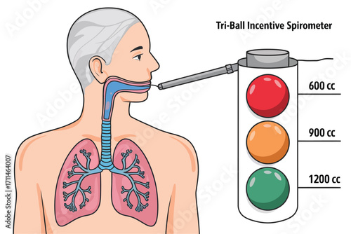 Using an Incentive Spirometer Deep Breathing Exercise for Lung Health