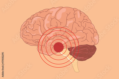 Human brain illustration with red target highlighting pain, injury, or neurological disorder.