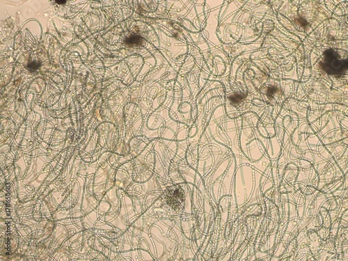 Foto Brightfield micrograph of Nostoc commune cyanobacteria at 100x magnification