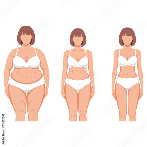 Weight loss journey stages of a woman in underwear.