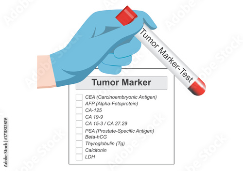 Tumor marker is a substance used to help detect diagnose and monitor the treatment or recurrence of cancer in the body.