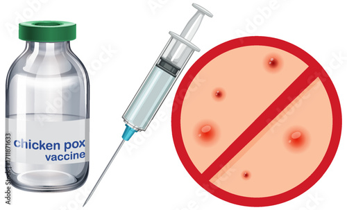 Chickenpox Vaccine Syringe and Immunization Concept Illustration