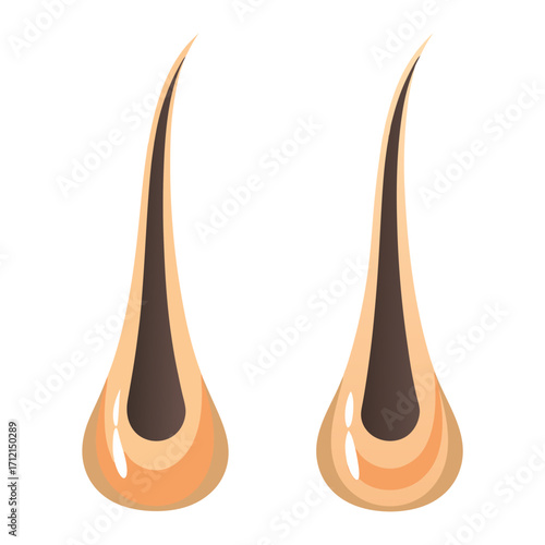 Cross section of healthy and damaged hair follicles