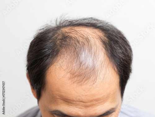 Bald Middle-aged Korean Man Top View