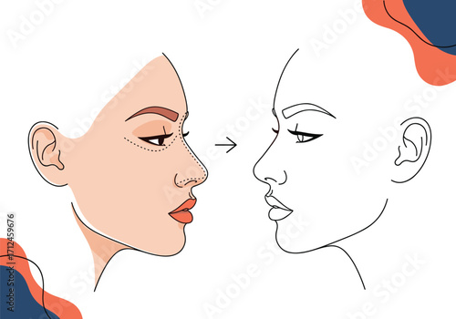 Illustrations of a woman's profile undergoing facial contouring.