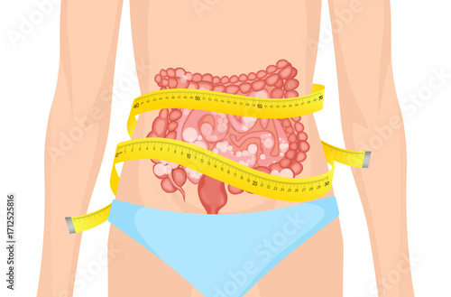 Measuring Tape Wrapped Around Woman's Abdomen Showing Bloated Intestines