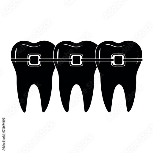 Vector art of three black teeth with metal braces illustration design
