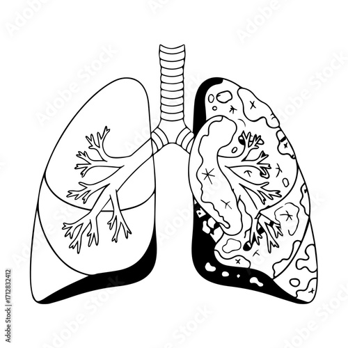 Detailed Black and White Illustration of Human Lungs with Anatomical Features.