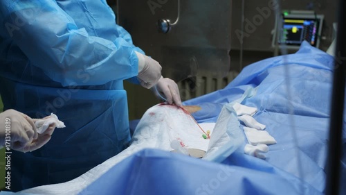 Surgeons' hands perform surgery close-up